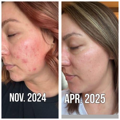 Customer photo Before